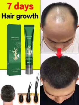 Масло за растежа на косата Бърз растеж на косата Ефективно средство от Наследствено оплешивяване, косопад Послеродовое косопад Себорейное косопад